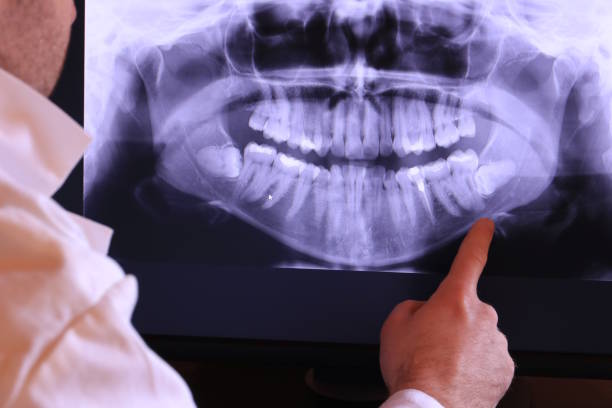Best Pediatric Emergency Dentist in Irwin, SC