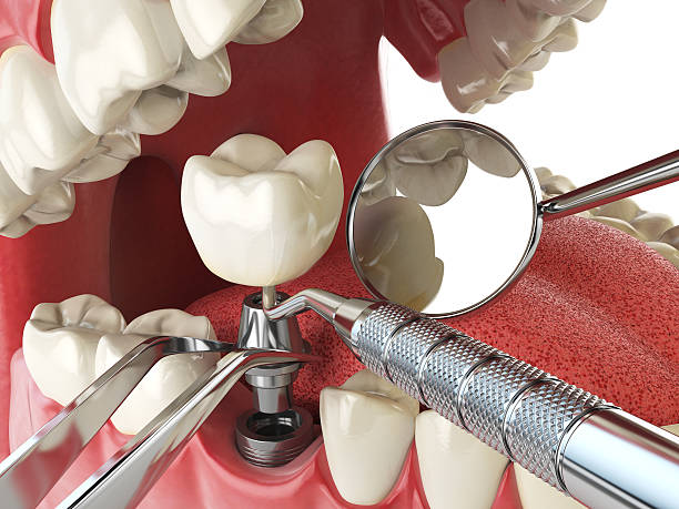 Best Emergency Dentist for Special Needs Patients in Irwin, SC